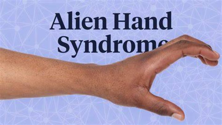 Alien Hand Syndrome