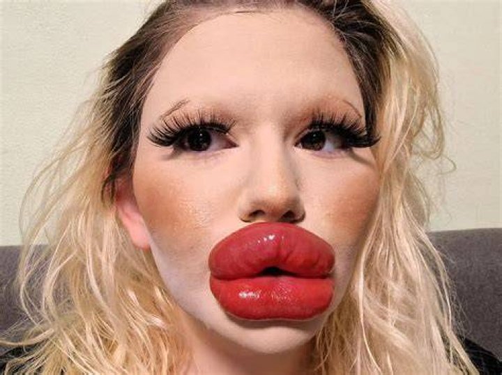 Andrea Ivanova Showing Biggest Lips In The World