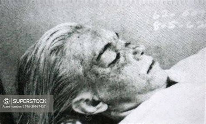 Autopsy Of Marilyn Monroe
