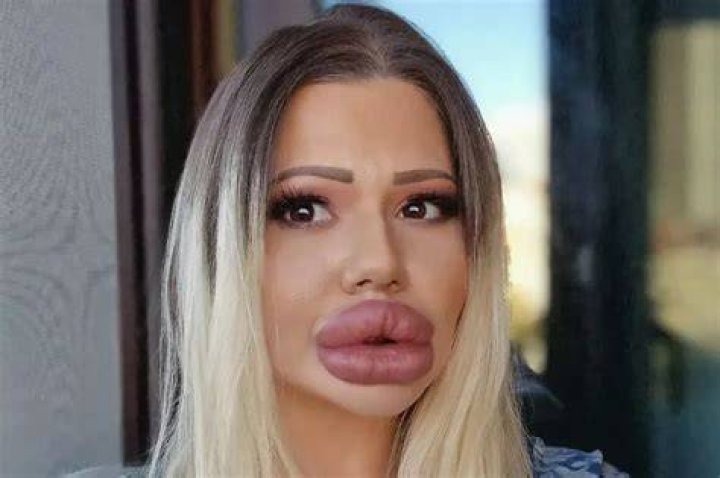 Biggest Lips In The World