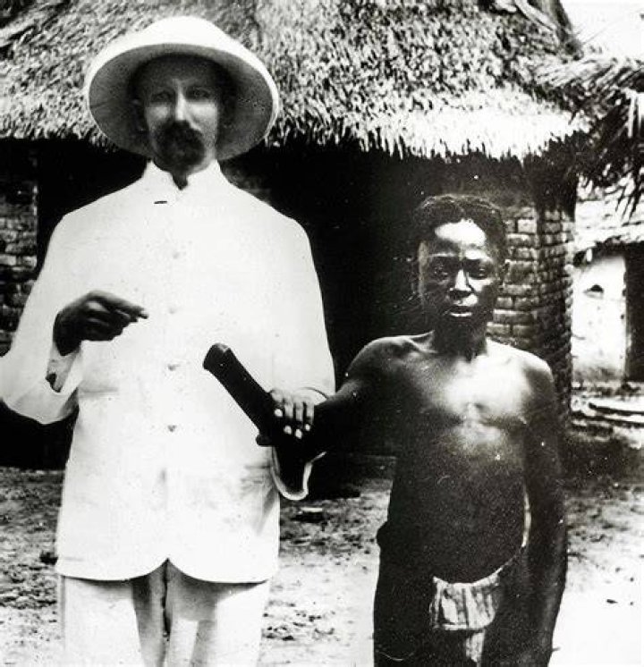 Congo Amputations
