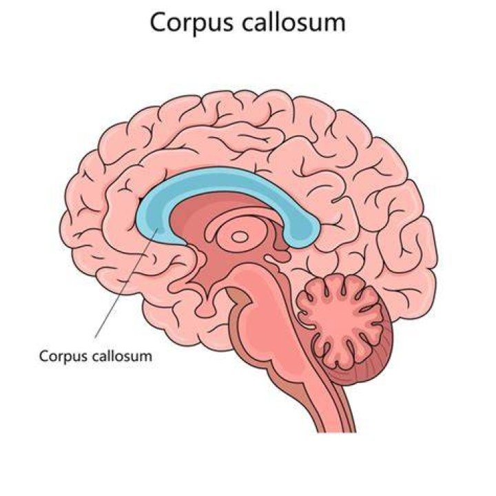 Corpus Callosum