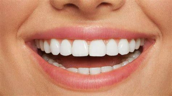 ¿Dale tiene 2 dientes? – Celebrity.fm