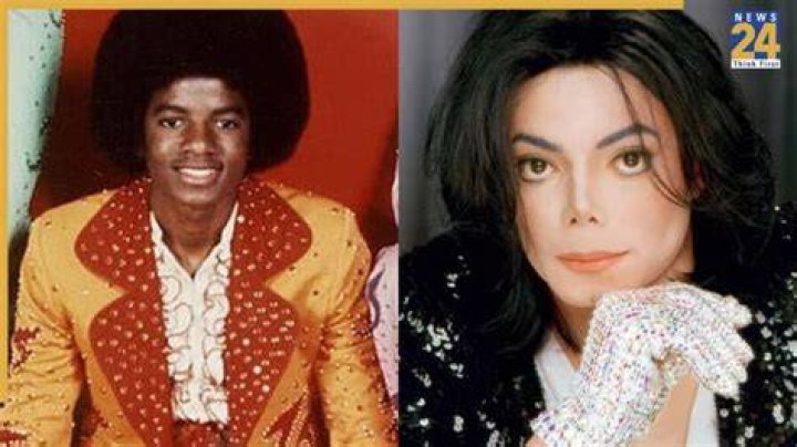 Does Charlemagne bleach his skin?