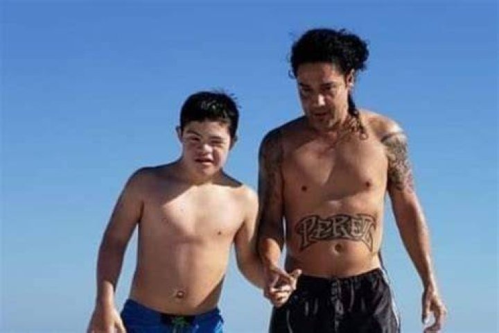 Does Chris Perez son Noah have Down syndrome?