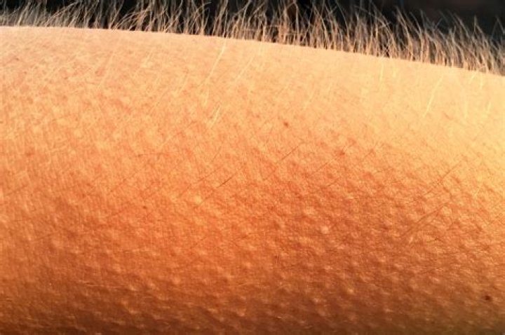 Goosebump Arm