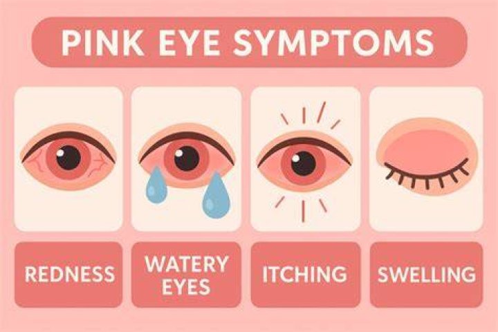 How to know if pink eye is healing