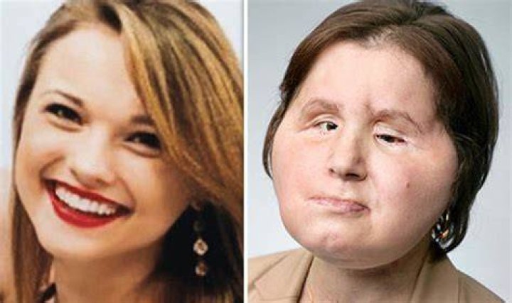 
Katie Stubblefield Before and After Accident: Why Did She Shot Herself? 
