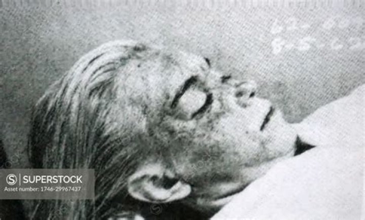 Marilyn Monroe Autopsy