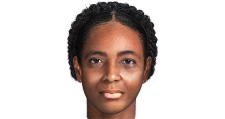 Martha Peterson Facial Reconstruction