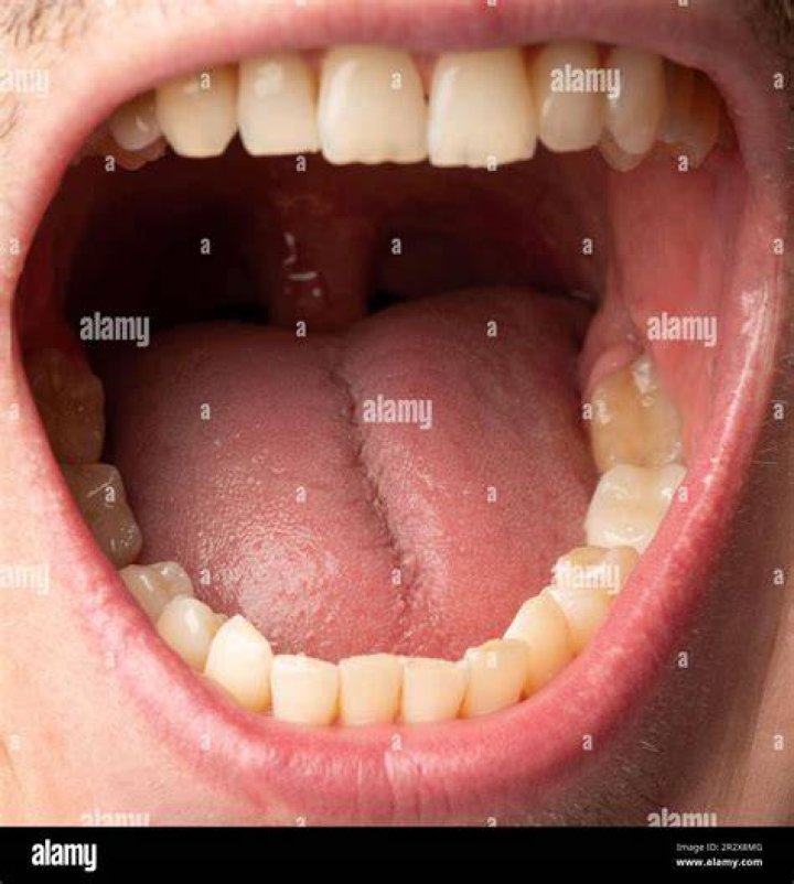 Mouth Open