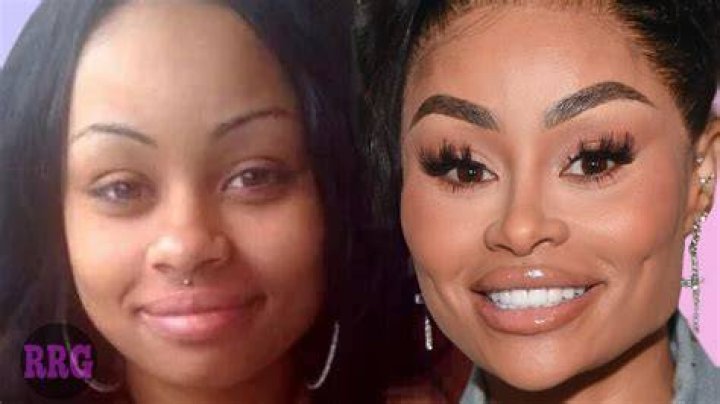 Plastic Surgery?Blac Chyna Looks Completely Unrecognizable in These Throwback Pics