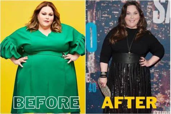 Que doença Chrissy Metz tem?