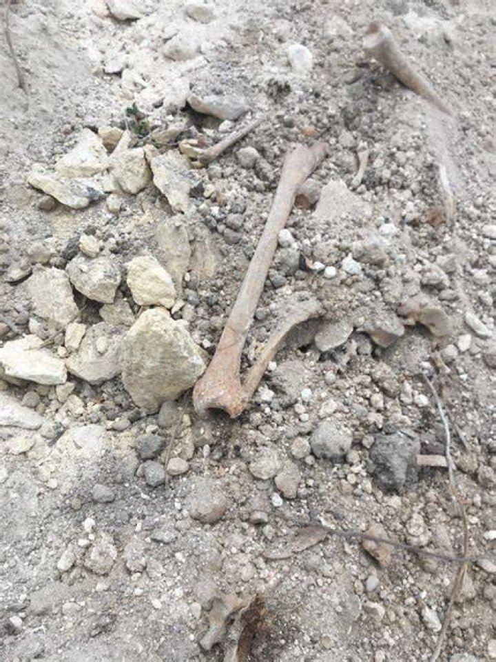 Skeletal Remains At Vesuvius