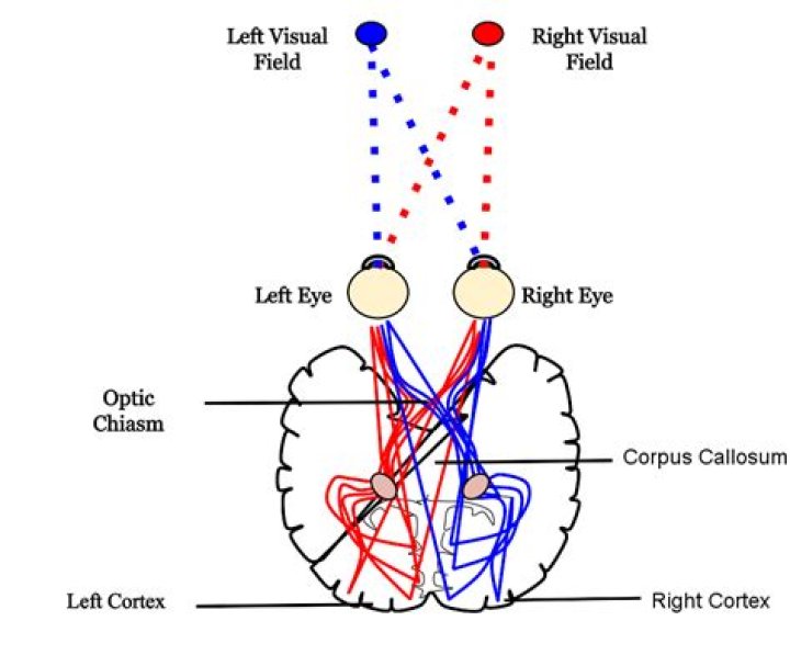 Split Brain Diagram