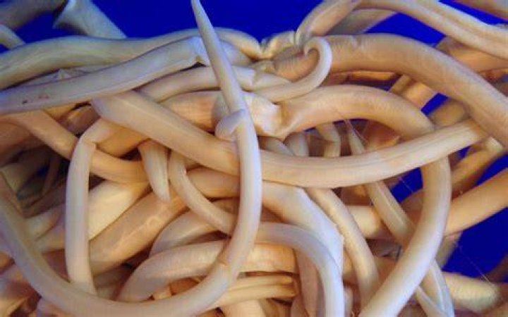 Tapeworm Museum