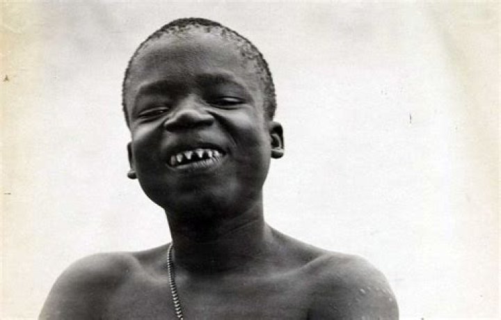 Teeth Of Ota Benga