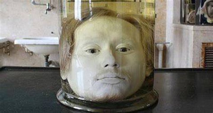 The 19th-Century Killer With A Perfectly Preserved Head