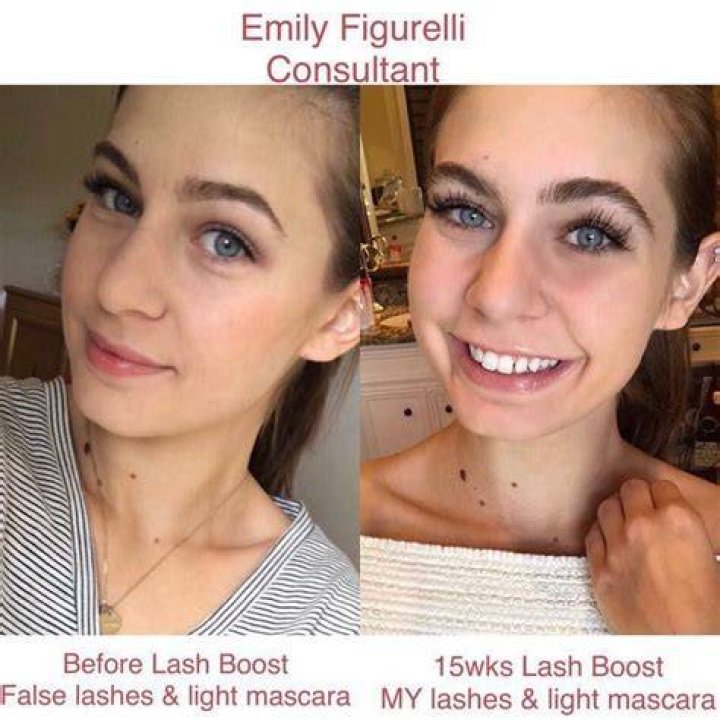 Which is better Latisse or Rodan and Fields?